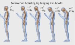 gewicht hoofd gebruik telefoon